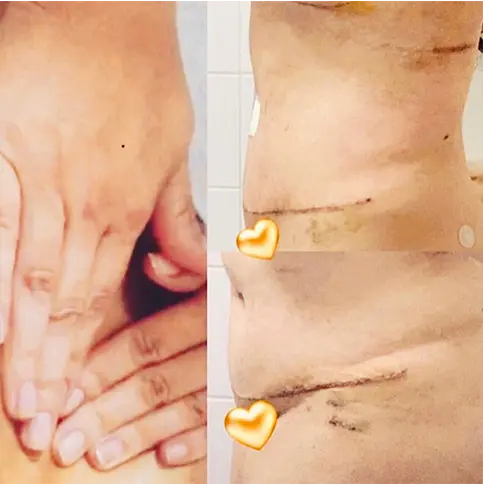 Cirurgia Plástica 1