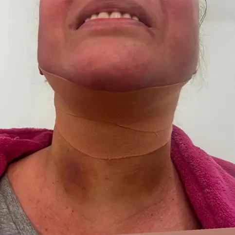 Cirurgia Plástica 2