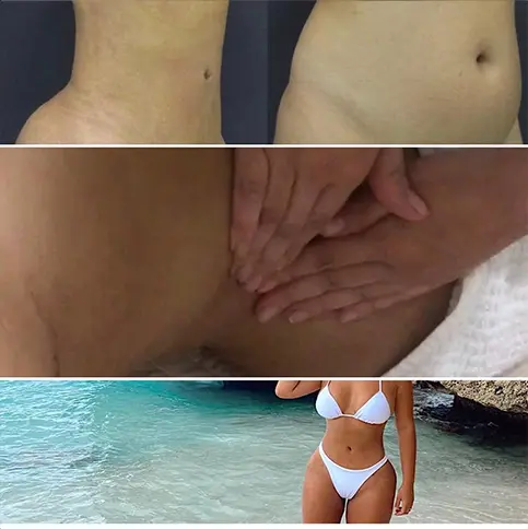 Cirurgia Plástica 5