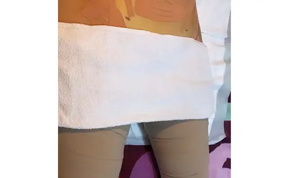 Fisioterapia para Lipedema